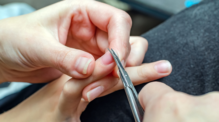 What the Ugly Lines on Your Nails Mean for Your Health and How to Get Rid of Them